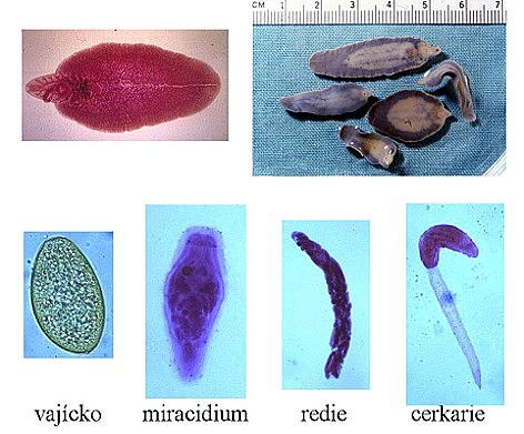 Deambrogio%20Fasciola%20hepatica%20stadi